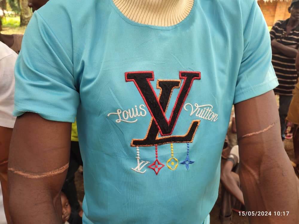 Tortura en los brazos de un miembro de la comunidad.