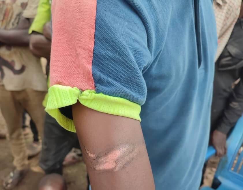 Tortura en el brazo de un comunitario